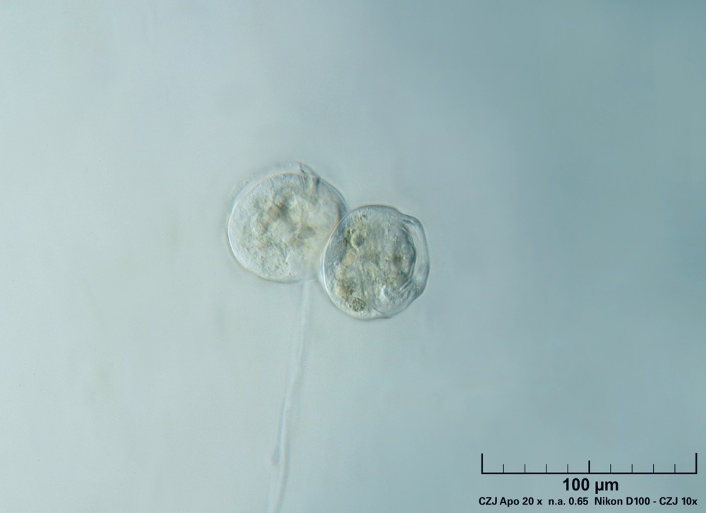 Vorticella